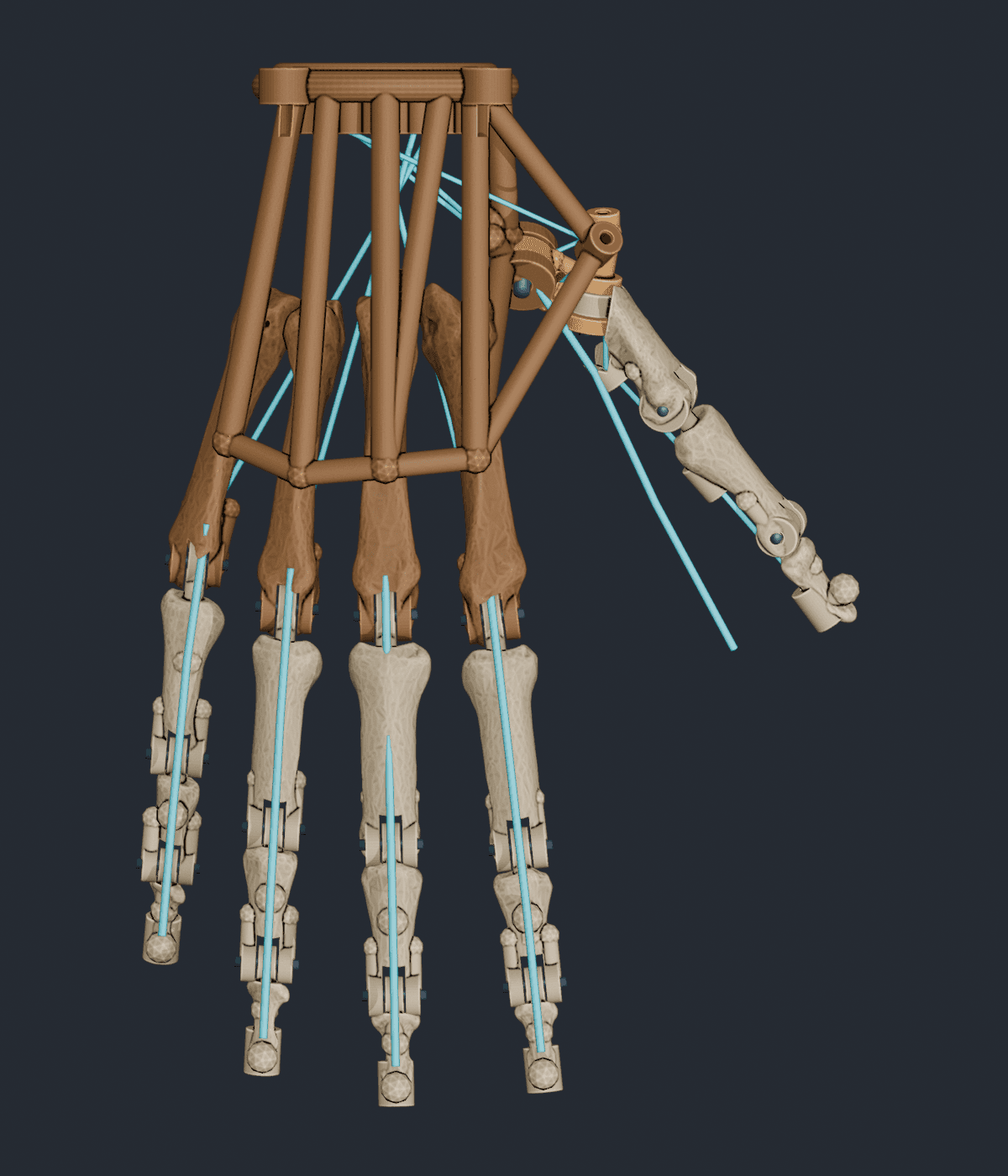 V3_01_Open_Top.png
